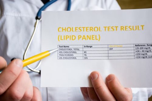 Doctor holding a chart showing cholesterol test results. Cholesterol disorders can be treated by our diabetes doctors in Idaho Falls and Pocatello.