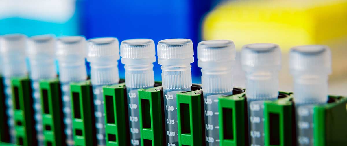 A row of laboratory test tubes as part of the research of our endocrinologists and diabetes doctors in Idaho Falls and Pocatello.