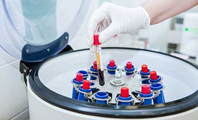 Medical laboratory technician with a test tube at Rocky Mountain Diabetes in Idaho Falls and Pocatello.