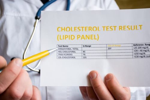 cholesterol test result.