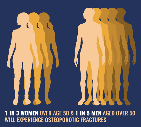 1 in 3 women and 1 in 5 men over 50 will experience osteoporosis fractures.