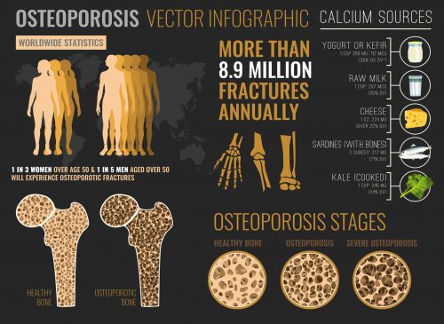 osteoporosis chart.